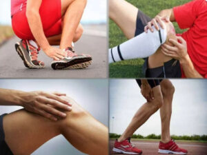 Спортивные травмы: травмы коленных и локтевых суставов, вывихи и растяжения.